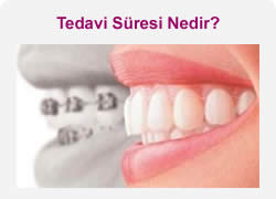 ortodonti tedavi süresi